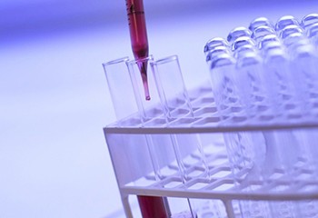 VIH/Sida : plus d’un tiers des découvertes de séropositivité sont trop tardives
