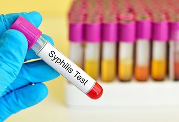 La syphilis fait un bond de 70% en Europe