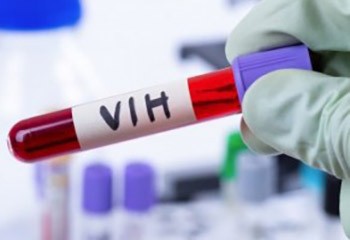 VIH / Sida Baisse significative des nouveaux diagnostics de séropositivité en France