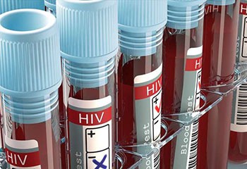 Une séropositivité VIH en baisse de 7%