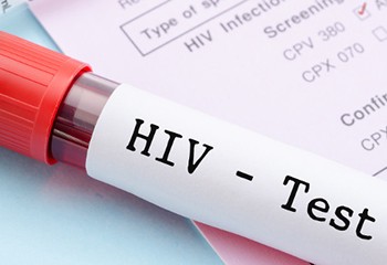 Echec d’un essai de vaccin contre le VIH