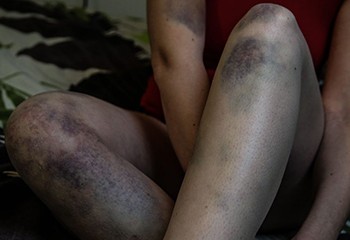 Confinement : des jeunes homosexuels plus exposés aux violences intrafamiliales