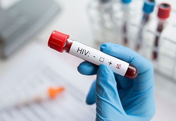 VIH/sida : rémission d'un patient séropositif sans greffe de moelle