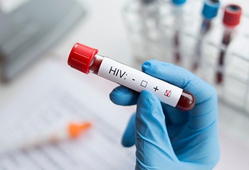 Hausse inquiétante du nombre des cas non diagnostiqués de VIH en Europe orientale