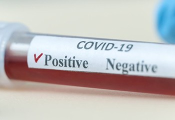 Covid-19 : les personnes vivant avec le VIH immunodéprimées, oubliées de la priorisation de la vaccination