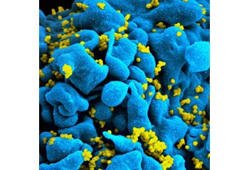 Le VIH peut être dupé dans une embuscade par des cellules tueuses – étude