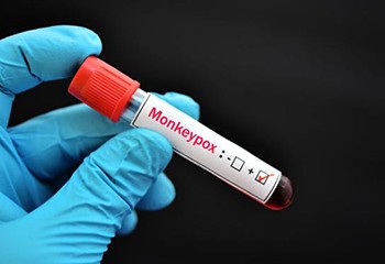 Monkeypox : recos plus précises